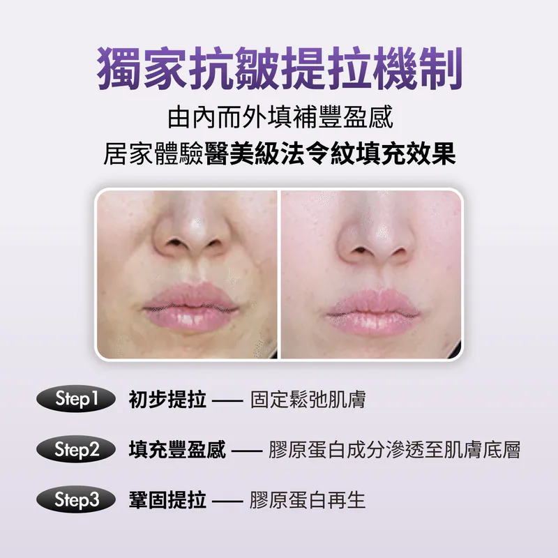کرم ضدچروک و احیاکننده خطوط اینت | Innete Revive Line Cream